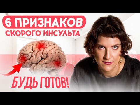 Видео: 6 признаков скорого ИНСУЛЬТА: будь готов