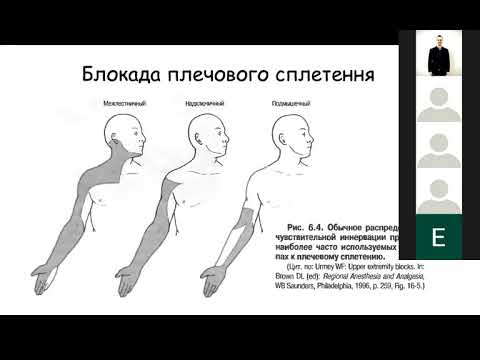 Видео: Регіонарна анестезія під УЗ-контролем