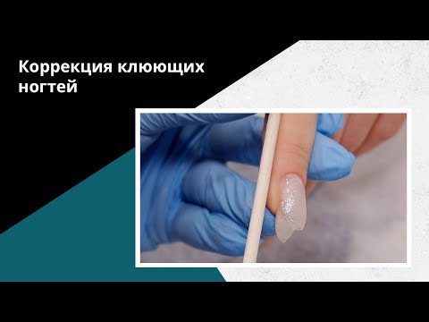 Видео: Как ПОДНЯТЬ клюющий ноготь. Коррекция акригелем.