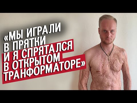 Видео: Меня ударило 10 000 вольт: Игорь | Быть молодым