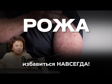 Видео: Рожа: избавиться навсегда! Калимолдаева Салтанат Булатовна