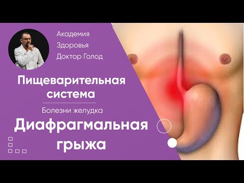 Видео: Диафрагмальная (пищеводная) грыжа.