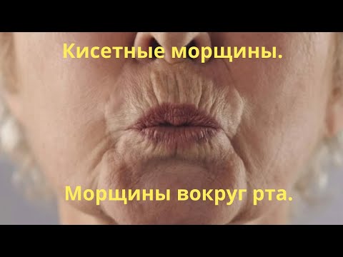 Видео: Кисетные морщины вокруг рта. Домашняя маска для губ от морщин. Омоложение губ.