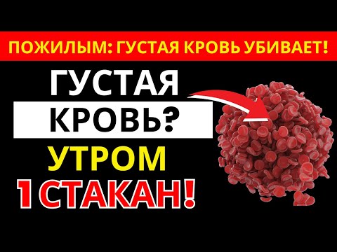 Видео: Боишься тромбов после 60? Пей это утром и избегай этих 3 ошибок |  здоровье пожилых