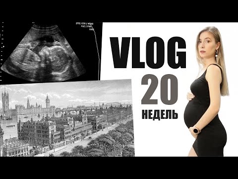 Видео: VLOG: ГОСПИТАЛЬ и УЗИ 20 НЕДЕЛЬ БЕРЕМЕННОСТИ