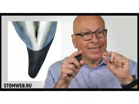 Видео: Реставрация передней группы зубов