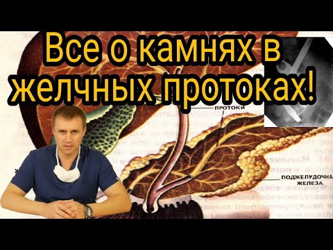 Видео: Камни в желчных протоках. Причины. Устранение.