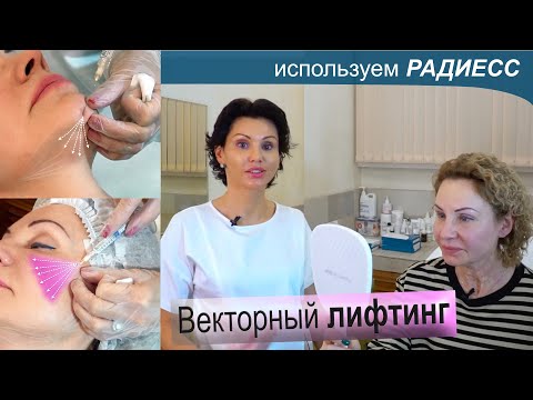 Видео: Делаем инъекции Радиесс (векторный лифтинг) и отвечаем на вопросы. Варвара Зайцева - врач-косметолог