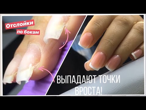 Видео: Выломанные углы/ Сложная коррекция ногтей и Френч