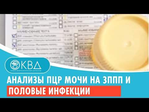 Видео: Анализы ПЦР мочи на ЗППП и половые инфекции. Клинический случай №155
