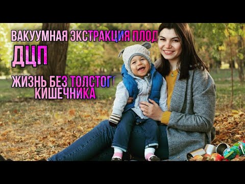 Видео: Любовь и её история родов. Асфиксия. Вакуумная экстракция плода. ДЦП. Отсутствие толстого кишечника.