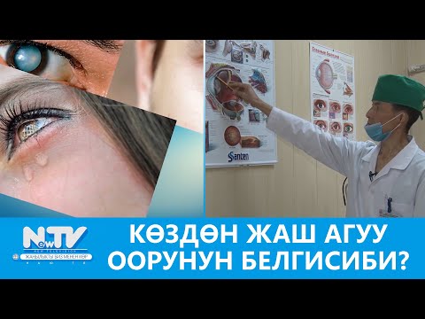 Видео: NewTV// КӨЗДӨН ЖАШ АГУУ ООРУНУН БЕЛГИСИБИ? // #ДАБАГЕР