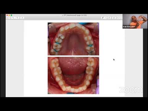 Видео: Последователи на дисциплината "Алекзандър" - епизод 2: д-р Крум Дечев