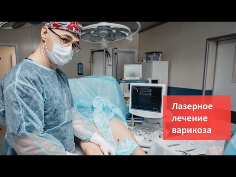Видео: Лазерное лечение варикозного расширения вен в Клинике Доктора Фомина. Метод ЭВЛО/ЭВЛК