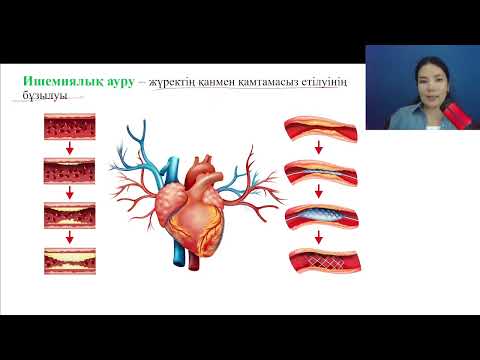 Видео: Адамның жүрек-қантамыр жүйесі аурулары | Аяжан Тұрдалы
