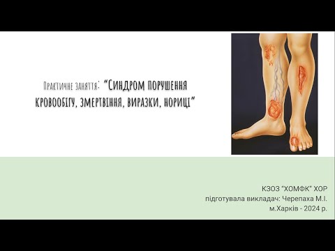 Видео: Практичне заняття: Синдром порушення кровообігу, змертвіння, виразки, нориці