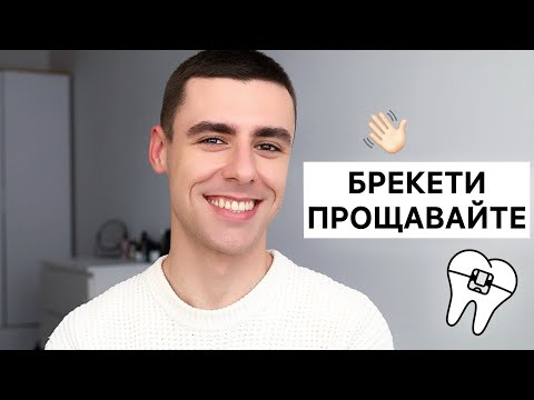 Видео: Мені зняли БРЕКЕТИ! | Очікування та реальність | ДО та ПІСЛЯ