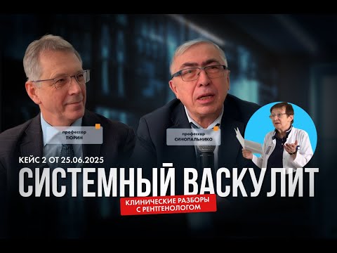 Видео: Клинические разборы с рентгенологом.Кейс 2. Системный васкулит от 25.06