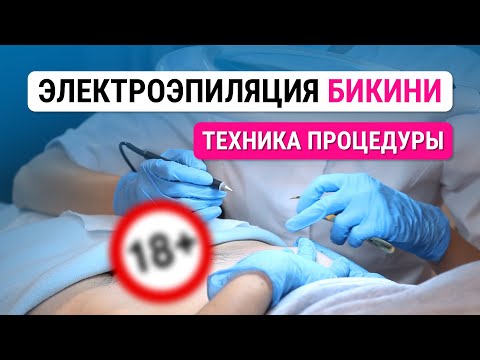 Видео: Урок №46. Электроэпиляция бикини: как правильно проводить процедуру электроэпиляции на бикини.