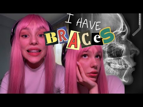 Видео: Я поставила Брекеты | vlog 🦷🪩