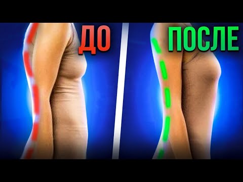 Видео: КАК ИСПРАВИТЬ ГИПЕРЛОРДОЗ? Вертикальная тренировка при лордозе поясничного отдела