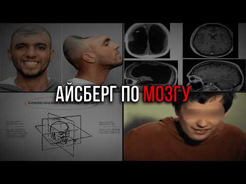 Видео: АЙСБЕРГ ПО МОЗГУ | Ч.2