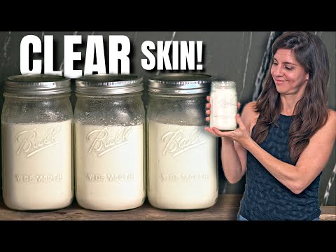 Видео: Этот йогурт изменил мою жизнь, синдром избыточного роста в толстой кишке, розацеа