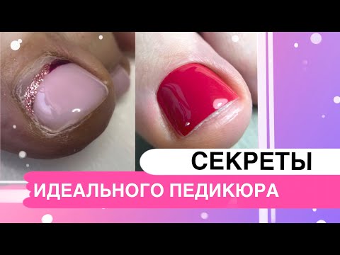 Видео: Педикюр еще проще и быстрее / Использую только эту технику / Секреты обработки пальцев ног