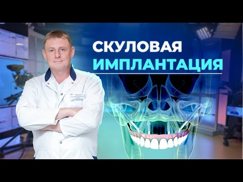 Видео: Скуловая имплантация вместо съемного протеза 💎