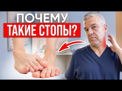 Видео: КАК УБРАТЬ ЗАВАЛ СТОПЫ ВО ВНУТРЬ? Самый эффективный способ устранения проблемы