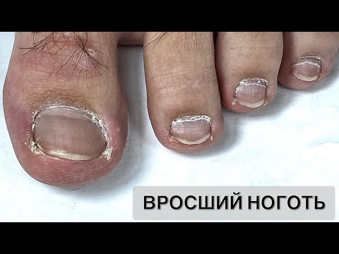 Видео: ПЕДИКЮР ОНЛАЙН. Виктория Авдеева