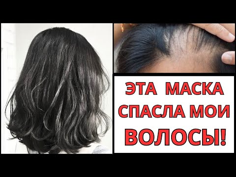 Видео: ВОЛОСЫ БУДУТ, КАК В РЕКЛАМЕ! Просто АСПИРИН ! Очень СИЛЬНАЯ маска против ПЕРХОТИ и ВЫПАДЕНИЯ волос.