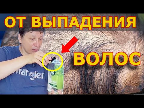 Видео: ДОБАВЬТЕ это В ШАМПУНЬ, чтобы ИЗБАВИТЬСЯ ОТ ВЫПАДЕНИЯ ВОЛОС и СЕДИНЫ. От  секущихся кончиков ...