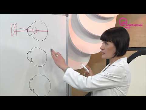 Видео: Доктор знает! Дальнозоркость и близорукость. Коррекция зрения | Телеканал "Открытый мир. Здоровье"