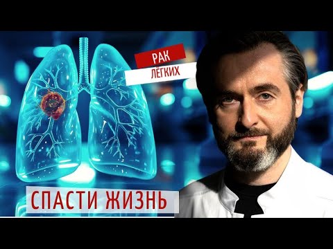 Видео: Как выявить рак лёгких вовремя? Важные советы врача-рентгенолога