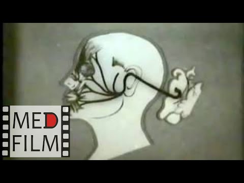 Видео: Поражение лицевого нерва, паралич лица © The injury of the facial nerve, facial palsy