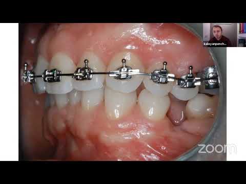 Видео: Последователи на дисциплината "Алекзандър" - епизод 1: д-р Калоян Пенчев