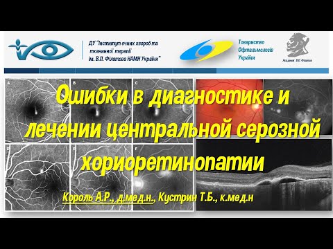 Видео: Ошибки в диагностике и лечении центральной серозной хориоретинопатии