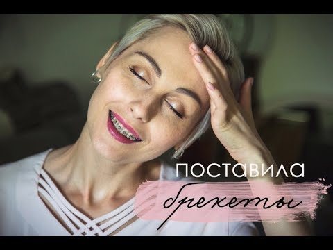 Видео: Спасибо Мари Новосад: Я ПОСТАВИЛА БРЕКЕТЫ!