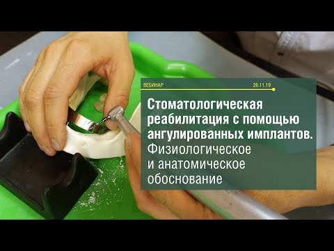 Видео: Стоматологическая реабилитация с помощью ангулированных имплантатов