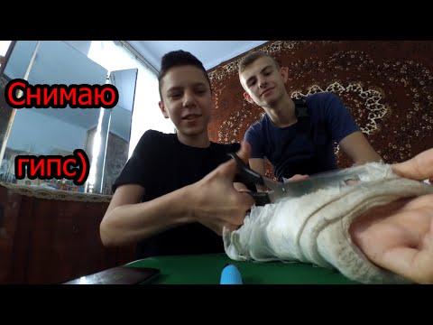 Видео: Снимаю гипс)