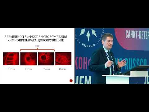 Видео: Химиоэмболизация злокачественной опухоли легкого как альтернатива хирургии