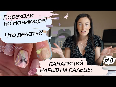 Видео: Паронихия, панариций или нарыв на пальце. Воспалился палец - что делать??