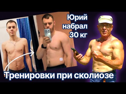 Видео: Юрий, 27 лет, набрал 30 кг. Онлайн тренировки при сколиозе