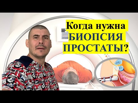 Видео: БИОПСИЯ ПРОСТАТЫ. КОГДА НУЖНА? КАК ВЫПОЛНЯЕТСЯ? ОСЛОЖНЕНИЯ!!!