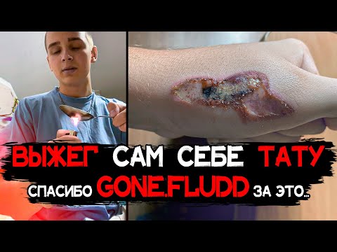 Видео: Зашквар от GONE Fludd: парень ВЫЖИГАЛ ПАРТАК | ТАТУ ПОРТЯТ ЖИЗНЬ