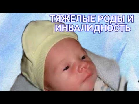 Видео: Рождение особенного ребенка/ Беременность и тяжелые роды/ Родовая травма, асфиксия новорожденного