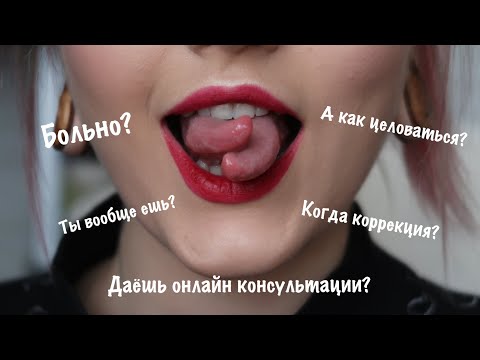 Видео: ЧАСТО ЗАДАВАЕМЫЕ ВОПРОСЫ ПРО СПЛИТ ЯЗЫКА | еда, коррекция, ощущения