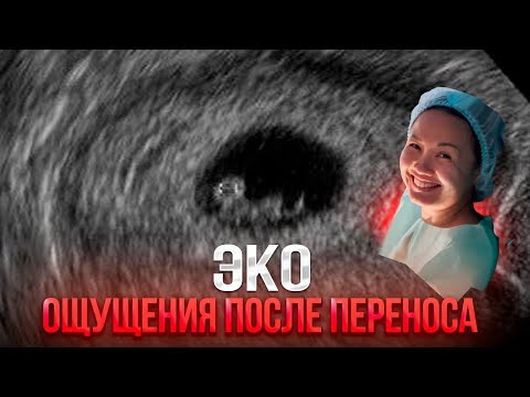 Видео: ЭКО. Криопротокол. Ощущения после переноса.