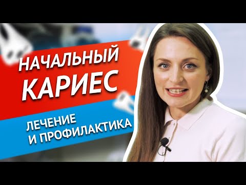 Видео: Начальный кариес | Как определить, лечение и профилактика | Развейте 5 главных заблуждений о кариесе